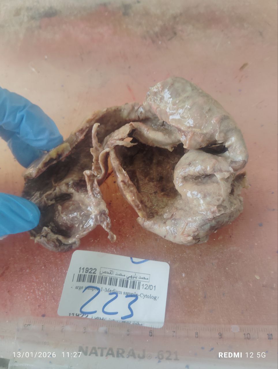 صورة التقرير