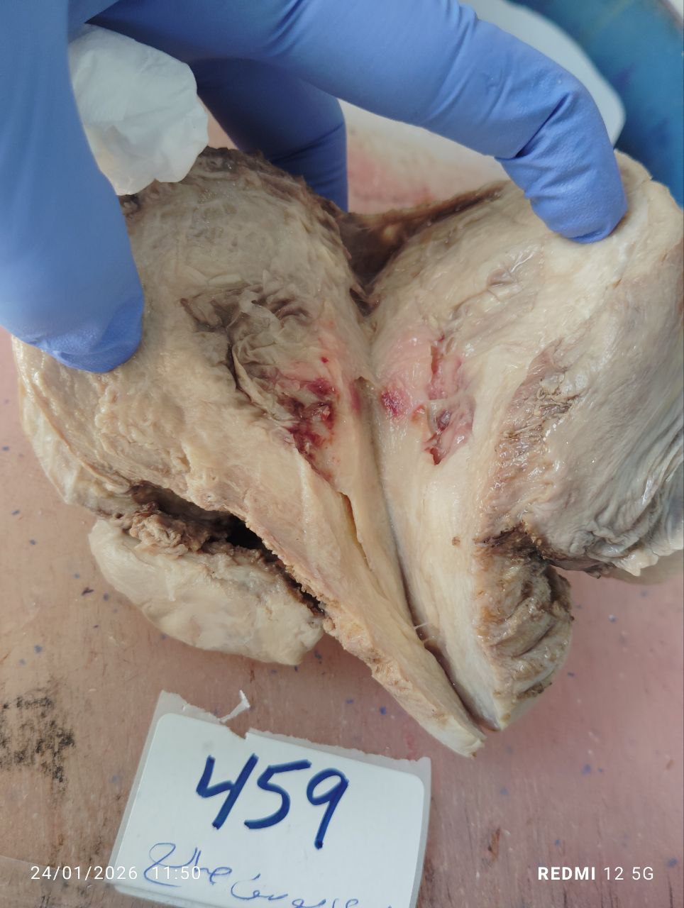 صورة التقرير