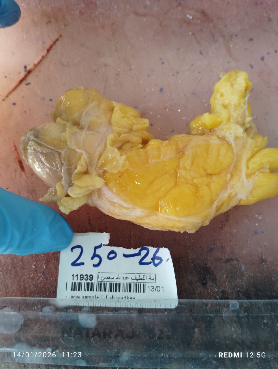 صورة التقرير