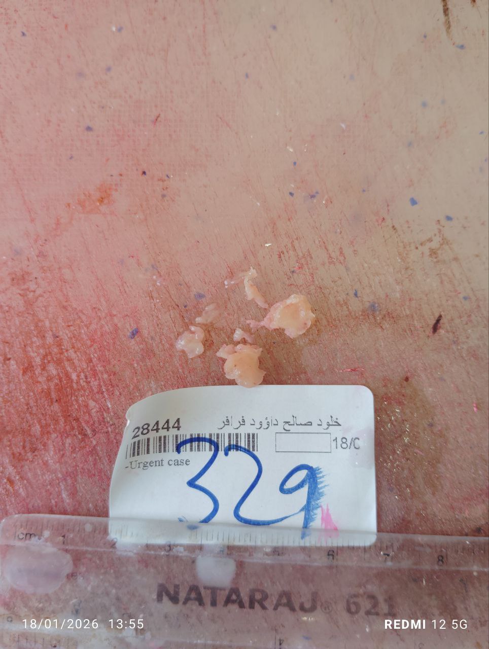 صورة التقرير