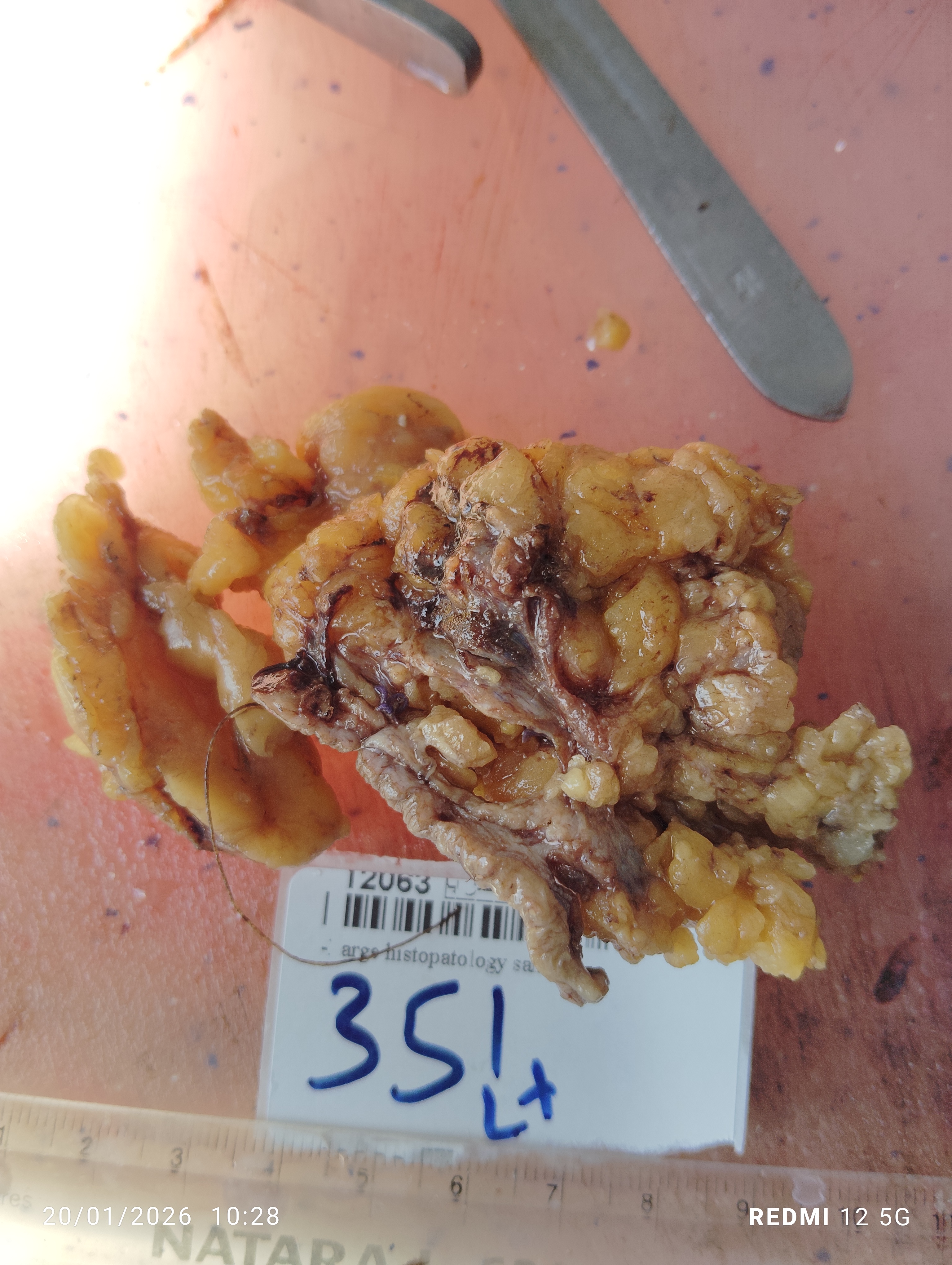 صورة التقرير