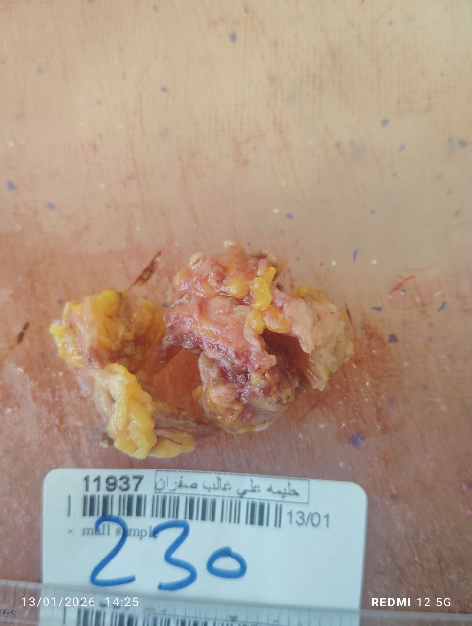 صورة التقرير