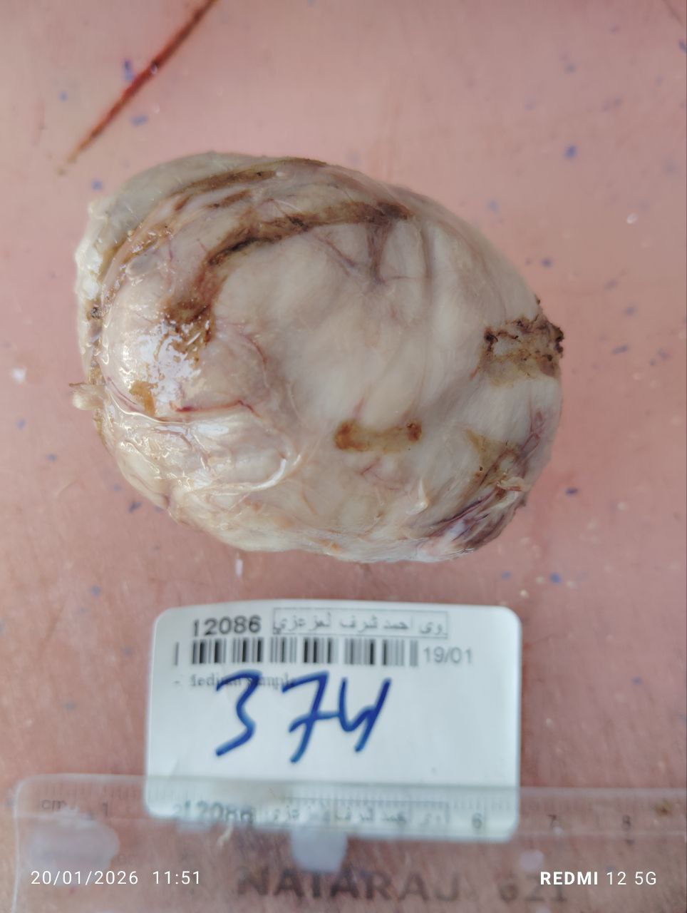 صورة التقرير