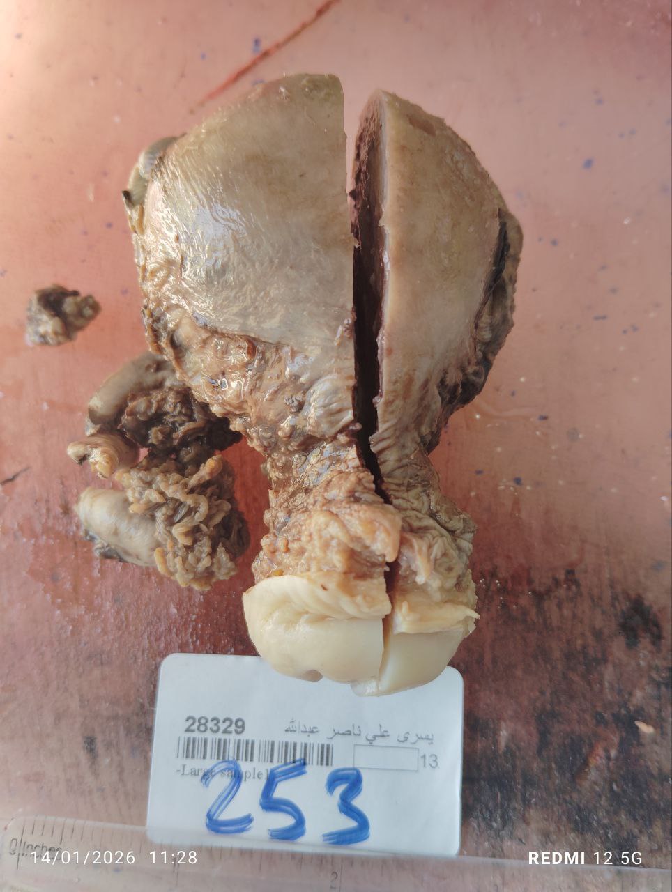 صورة التقرير