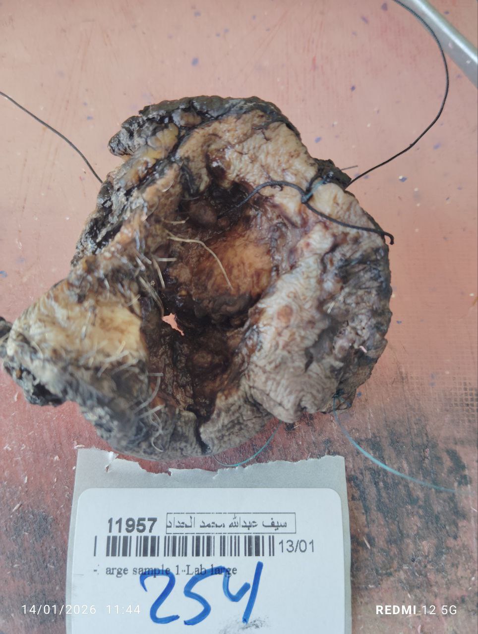 صورة التقرير