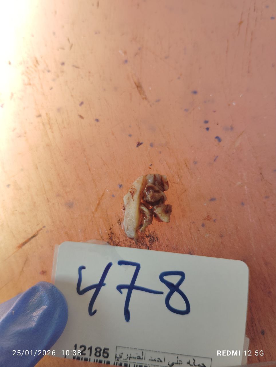 صورة التقرير