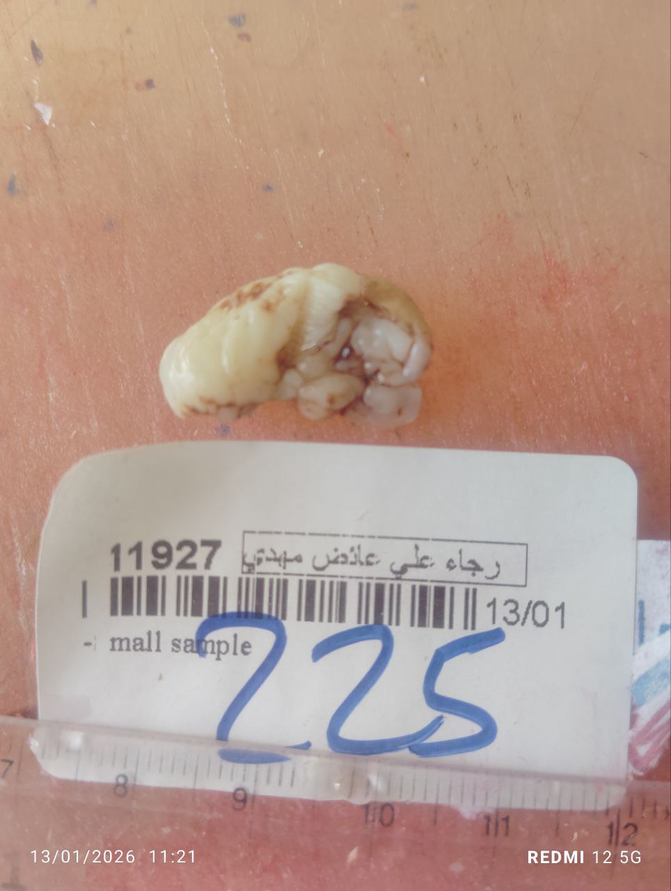 صورة التقرير