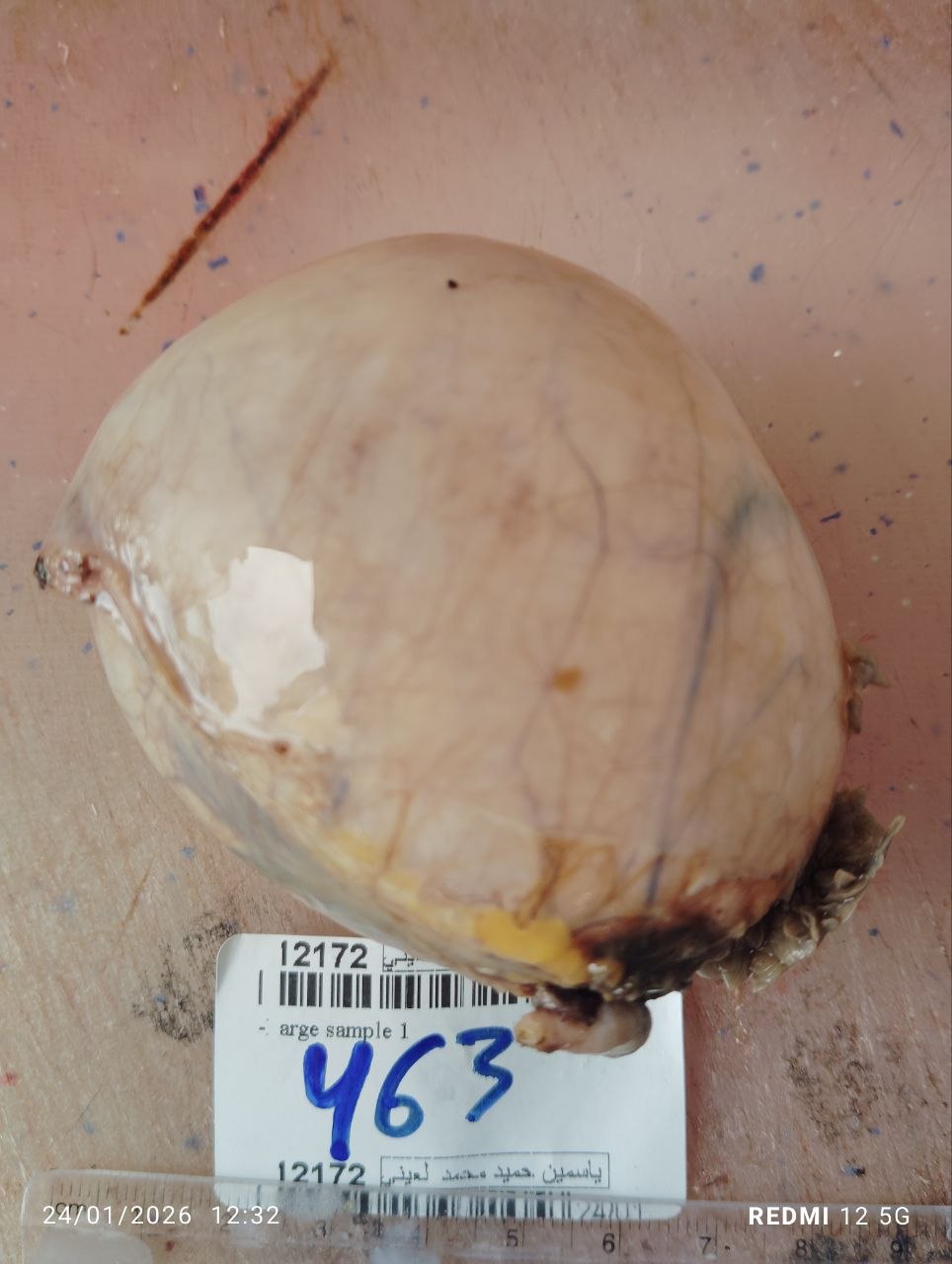 صورة التقرير