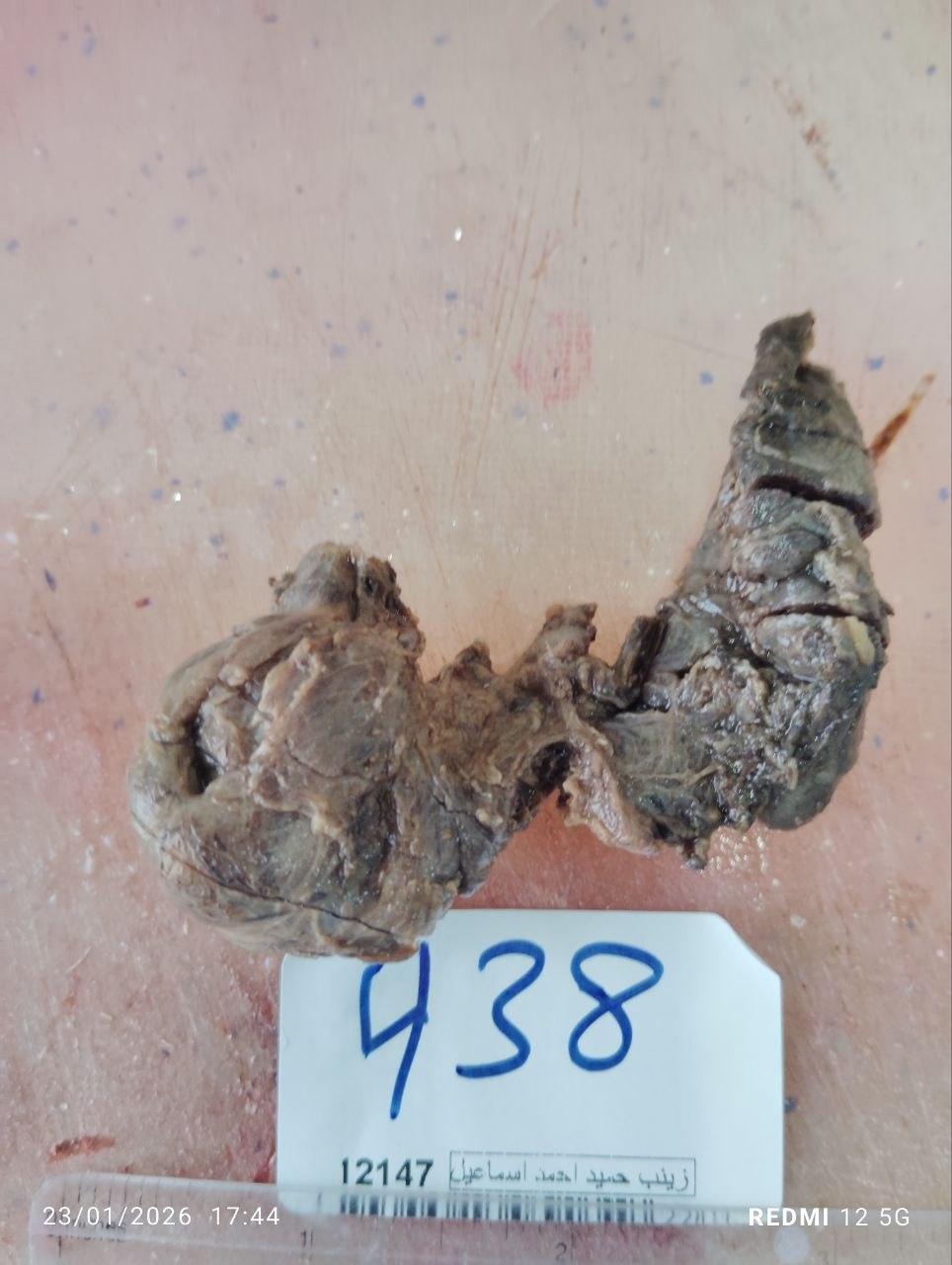 صورة التقرير