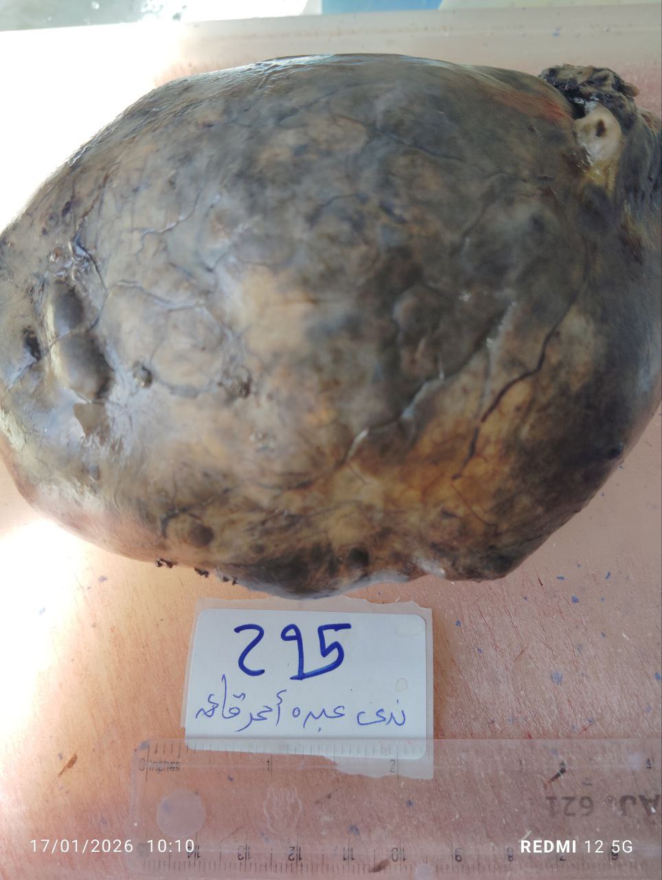 صورة التقرير