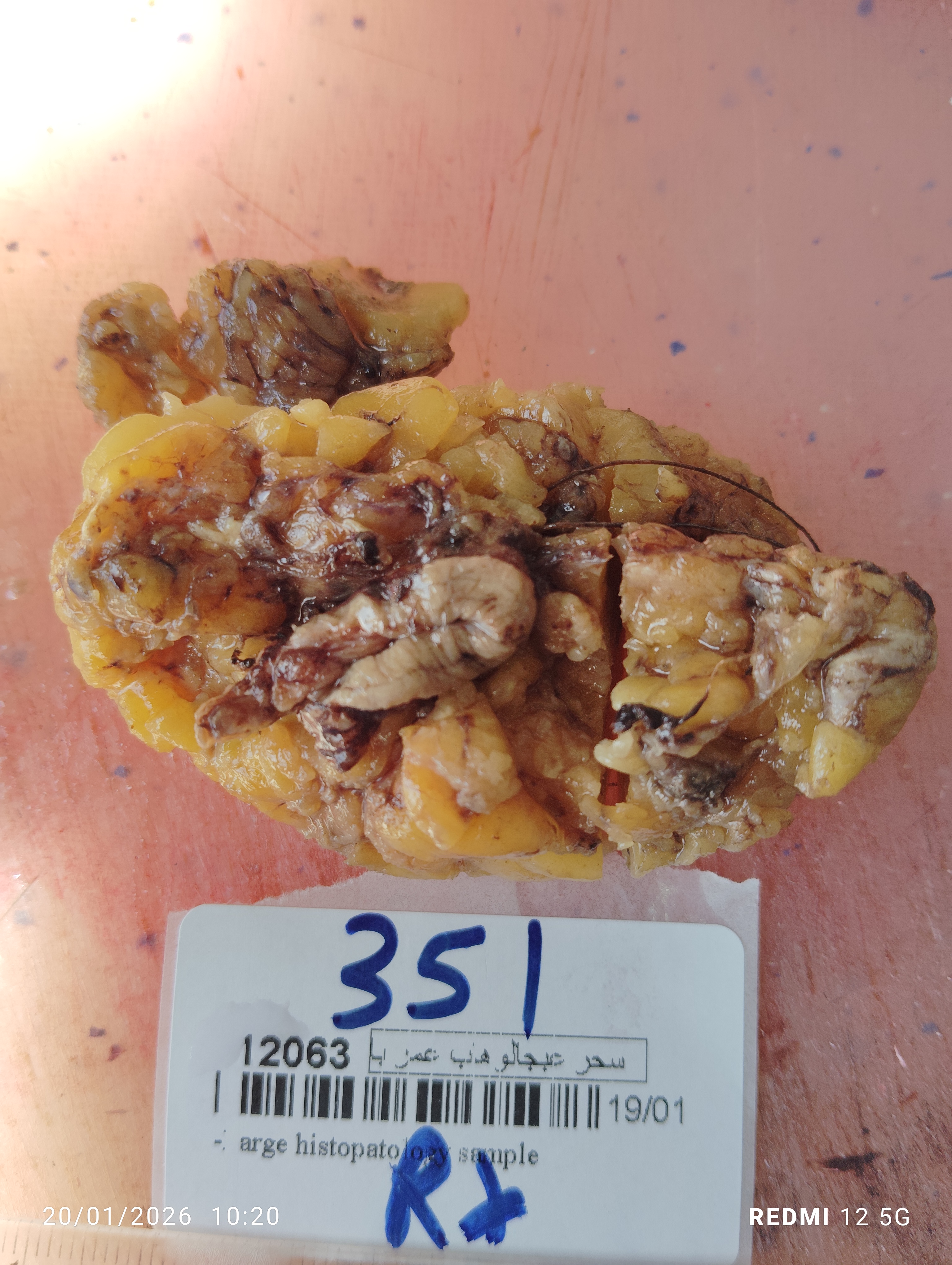 صورة التقرير